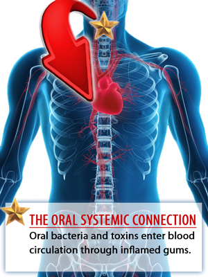 The Oral-Systemic Connection 